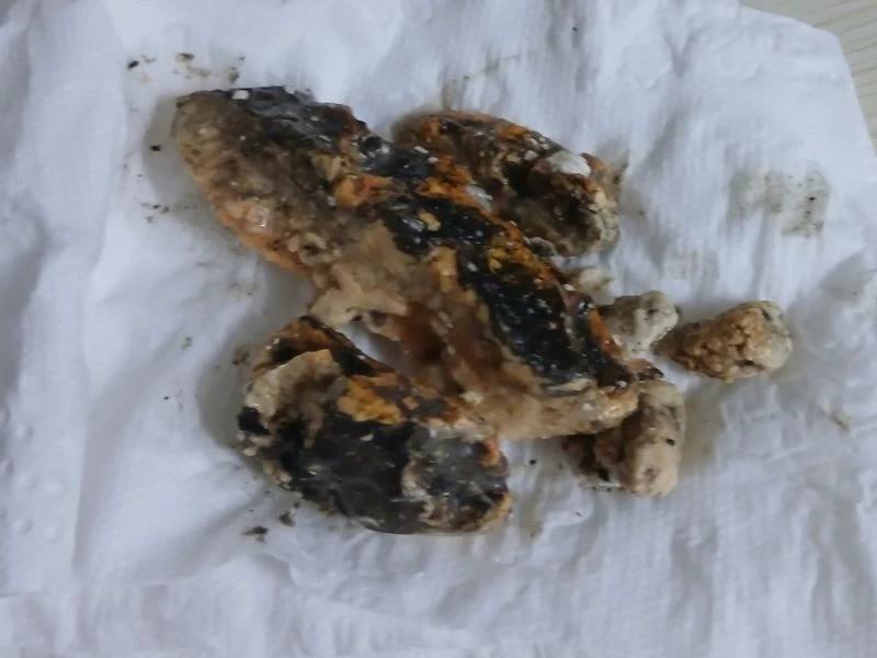 동대문구 배관 이물질 제거 사례 2